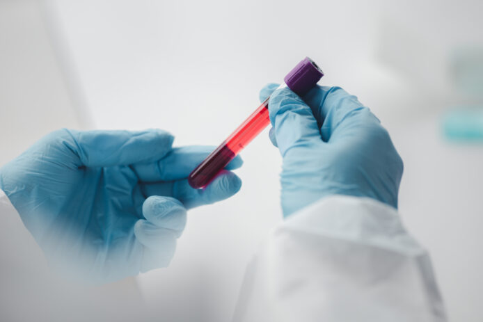 Lab technician handles a blood vial.